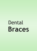 Dental Braces